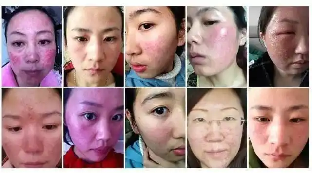 远离亚健康_怎样脱离亚健康_脱离亚健康的锻炼